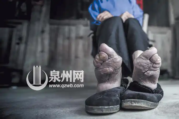 安溪桃舟裹小脚的耄耋老太
