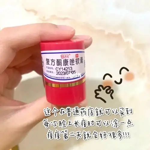 p1:复方酮康唑软膏在周边普通药店就可以有,大众话叫皮康王,我脸上起