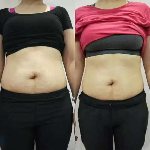 佳姆维密消脂塑型 产后修复特效班——香港知名瑜伽励