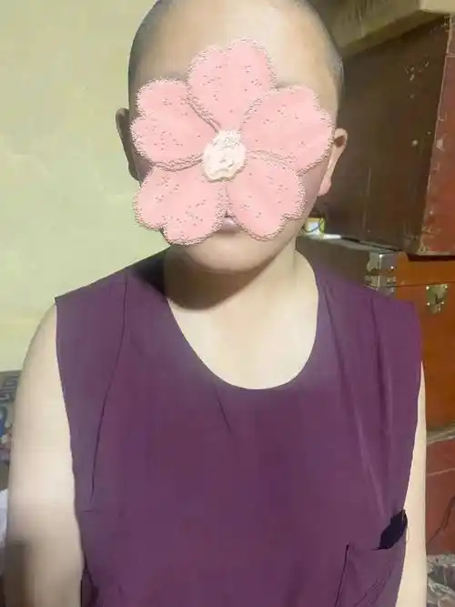 宝贝歪头杀又萌又可爱专家提醒别大意可能是斜颈惹的祸