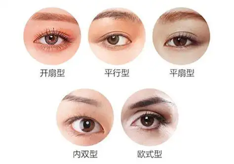 双眼皮全切和埋线哪个好?