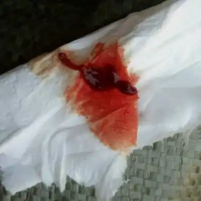 怀孕10周零几天见红,这是流产了吗