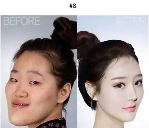 18个韩国人整形的例子,证实现在不需要投胎也能变女神!