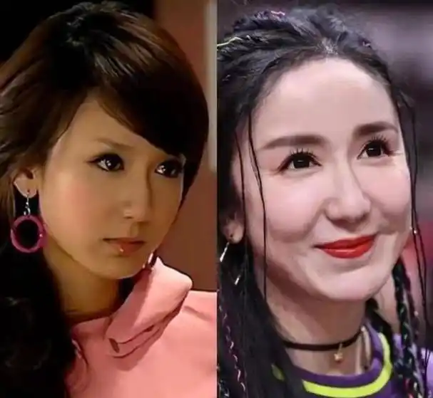 3位过度整容的女明星,面部僵硬很怪异,因动脸毁了自己的事业
