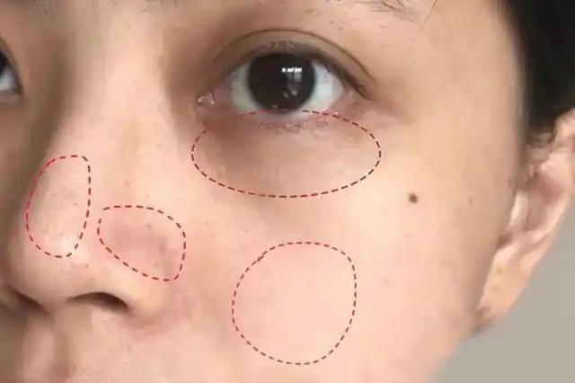 年纪大了皮肤越来越差?用再多护肤品,不如多睡几个好觉