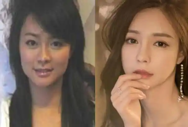 沈梦辰整容对比照素颜曝光沈梦辰杜海涛分手是真的吗