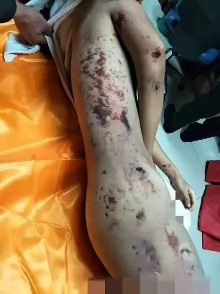 教师说,娜娜的家长当天来到学校后,校方就曾第一时间让家长去看遗体