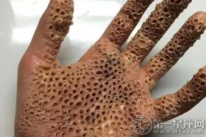 密集恐惧症慎入