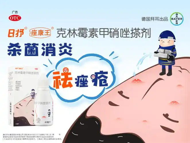 拜耳痤康王克林霉素甲硝唑搽剂40ml青少年治祛寻常痤疮毛囊炎祛痘脂溢