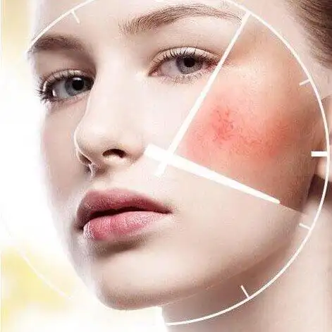 话事鹿说#04【问题型肌肤课堂——敏感肌管理】99敏_圈子-新氧