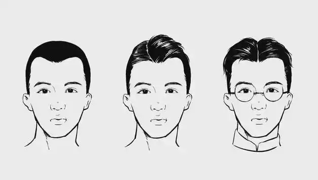 发际线秃了,还有救吗?