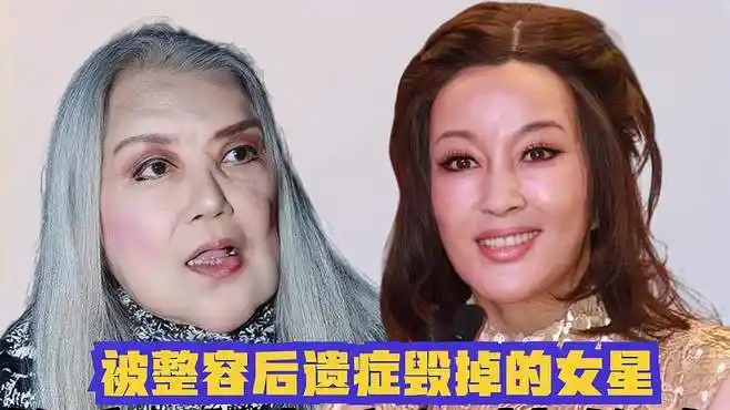 被整容后遗症毁掉的女星,刘晓庆宛如蜡像,蔡明脸僵笑不动