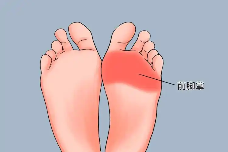 容易由于过度使用而出现各种问题,如前脚掌部位的骨质增生,筋膜炎