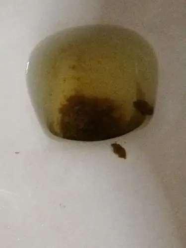 求医生帮我粗虐诊断一下,最近大便拉出来的都是一小点一小点,一般一天