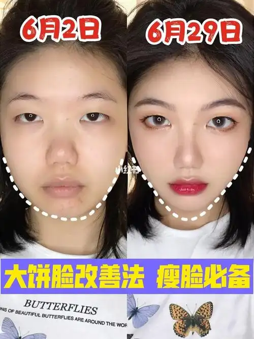87大饼脸改善全过程男女都能用的瘦脸法