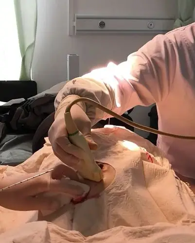 超声指导下乳腺肿物空芯针穿刺活检术