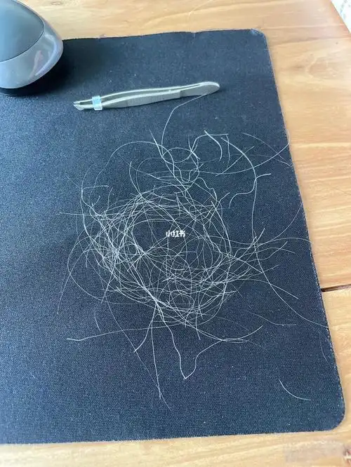 拔了100多根白发下来