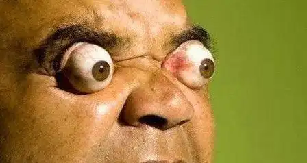 看好巴西男子爆眼球能弹出4厘米大神表演眼睛挤牛奶