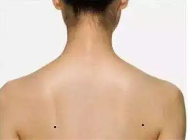 肩膀上有痣,是负担吗?肩膀上有痣负担大是真的吗?