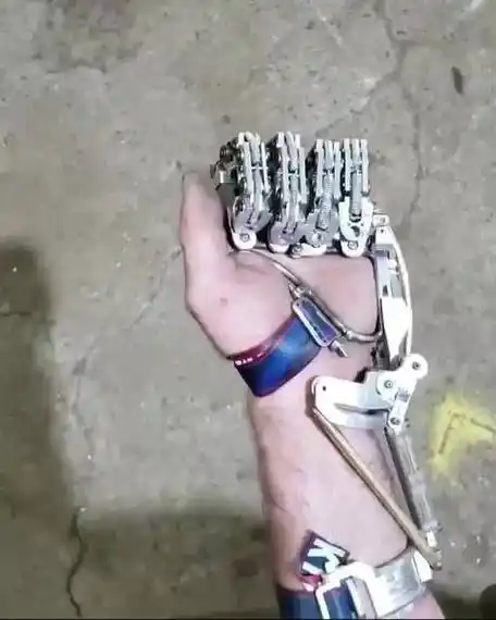 工程师的保险公司不支付假肢费用,所以他自己制作了假手