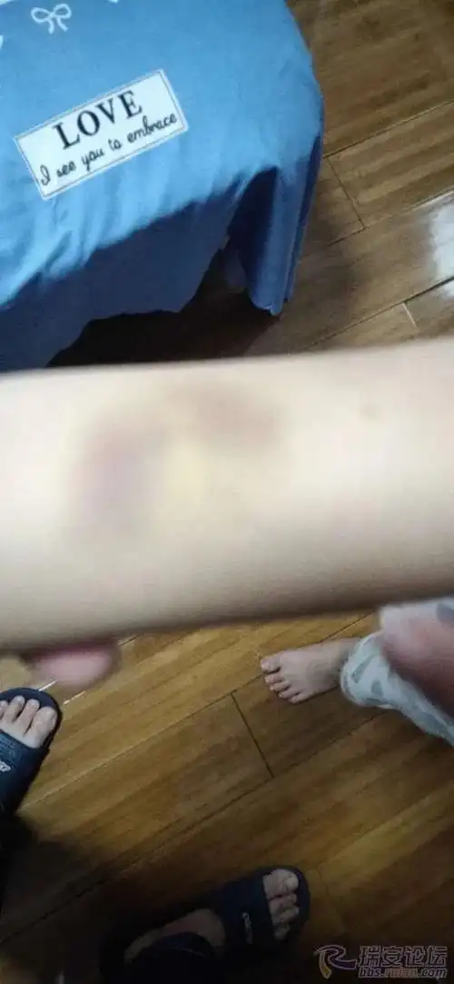 瑞安家长求助:孩子在学校被同学打,对方家长.