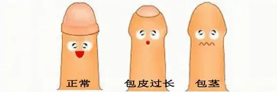 小孩包茎怎么办什么情况要做手术手术的最佳年龄是几岁