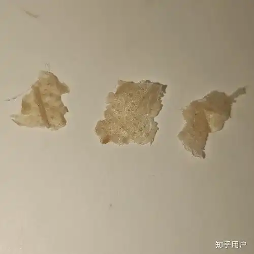 为什么抠下来大块的头皮屑会有瞬间的快感