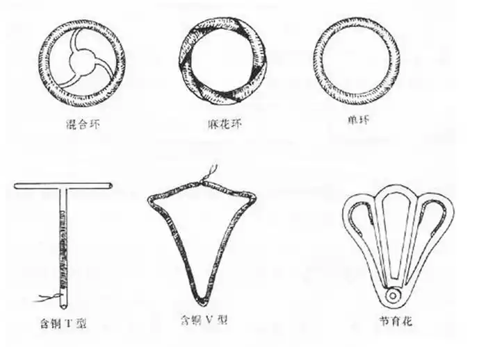 女性带节育环能一劳永逸?例假消失前记得取出来,否则身体恐遭殃