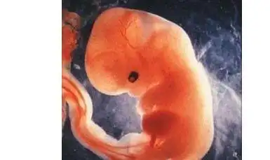 怀孕八周时被强噪声吵了五分钟,会影响到胎儿吗?