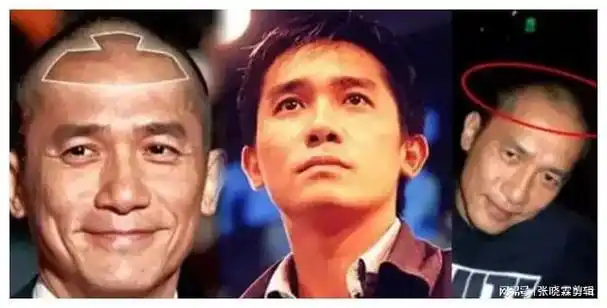 这6位男星的头,让女人好心碎|何炅|吴彦祖|发际线|梁朝伟|金城武