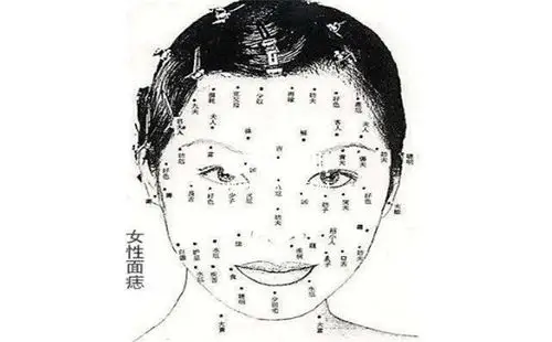 脚掌痣相图解,但是在线解析脚痣含义