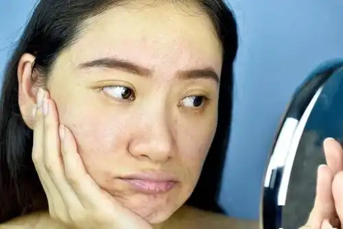 一旦皮肤缺水你就会比同龄人老10岁