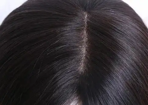 女性头顶长白发该如何调理(30岁女人头顶长白发的原因)(2)