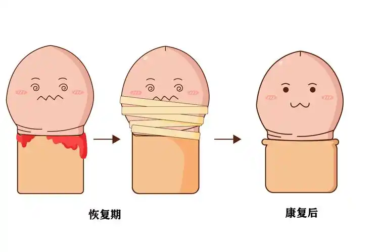 正常反应,一般2-3天之后会有所减轻,需要谨遵医嘱,做好包茎手术之后的