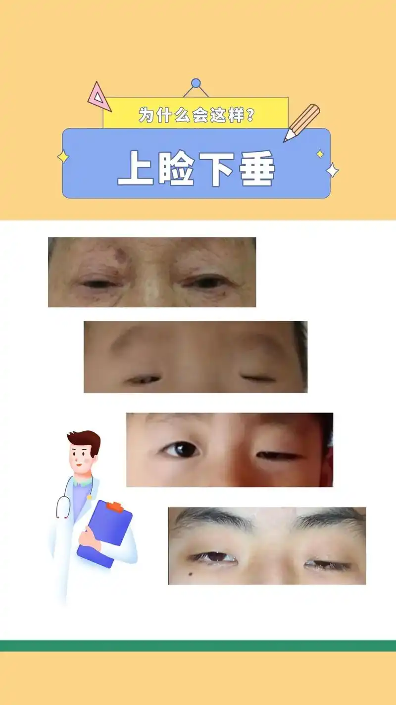 眼睛总是睁不开,呆滞无神?