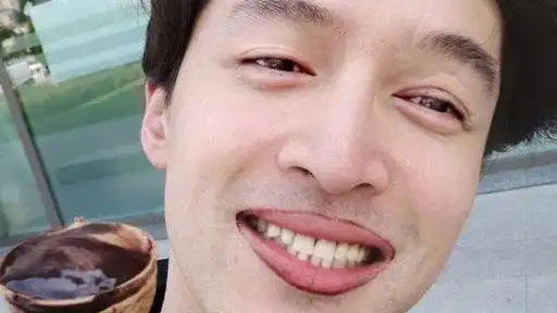 胡歌晒素颜自拍,脸上疤痕清晰可见,网友:请你撤回!