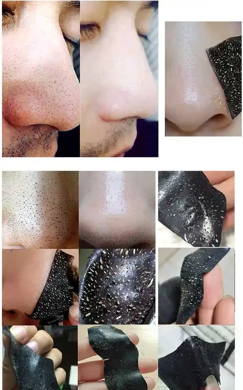 去黑头粉刺鼻贴收缩毛孔护理鼻贴膜男女撕拉式黑头贴学生厂家批发