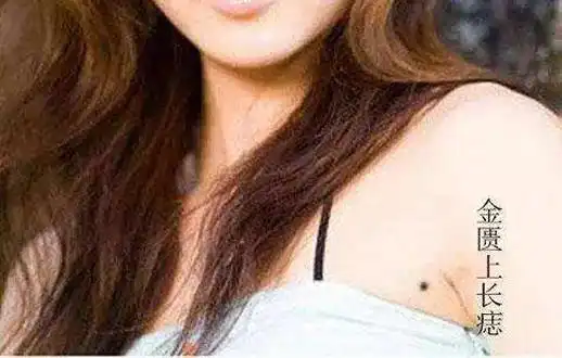 女人巨富痣长在哪里的女人巨富痣解读