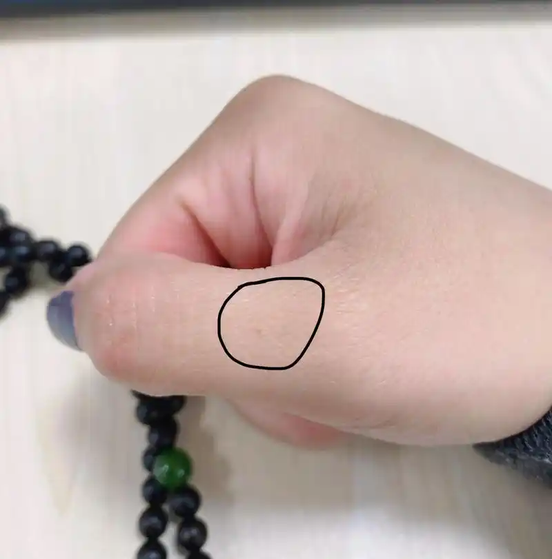 右手大拇指长痣是什么意思