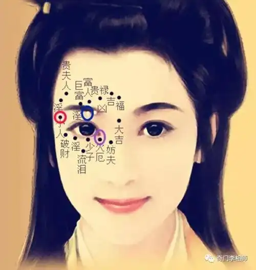 痣相:女人右眼出现的几种痣