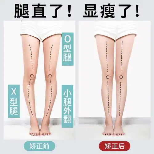 磁石腿型矫正小腿外翻xo型腿神器足弓支撑护脚足弓垫矫正器