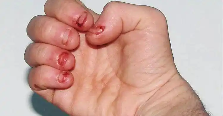 真实咨询案例孩子吃手背后的原因竟让妈妈泣不成声