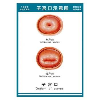 wsa51-21 子宫口示意图 60*40厘米 覆膜防水pp贴纸