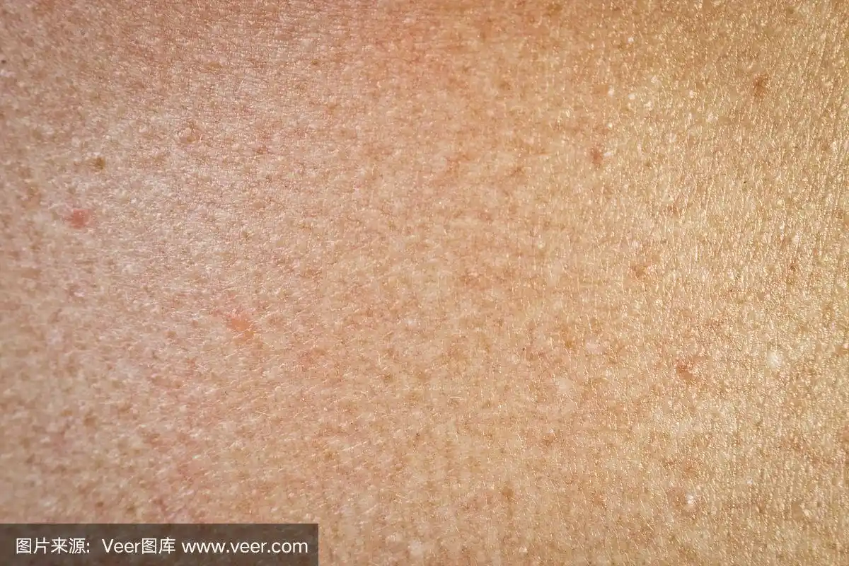 人类皮肤的纹理有雀斑和老年斑.