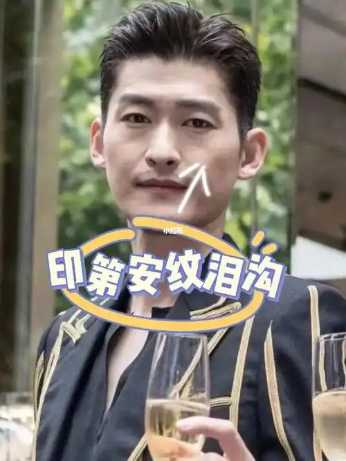 张翰脸上的泪沟印第安纹,四大原因分析