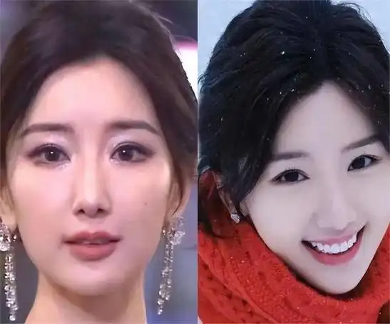 网友质疑毛晓彤"整容",在《庆余年》里,"假体"都要飞出来!