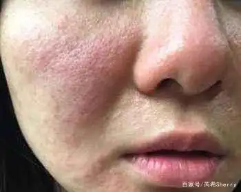 一款大人小孩都能用的面霜,内含南极丛耿藻,改善皮肤泛红干痒