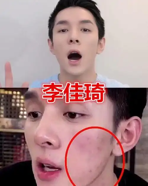 艾比素颜七鹤大人素颜李佳琦素颜看到她素颜对不起失恋了