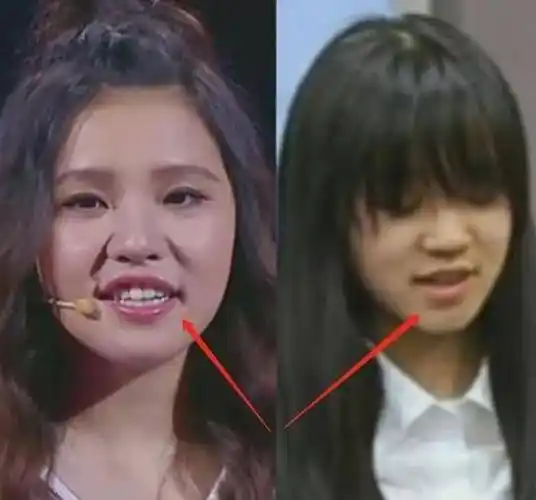 宋雨琦素人时期照片被扒出有没有整容一目了然韩国包装太强大