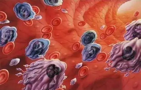 毒素和脂肪颗粒等废物,这些毒素,废物和杂质,内源性垃圾等总称为血毒